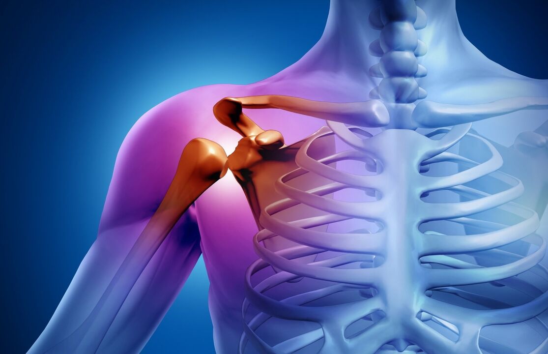 shoulder osteoarthritis