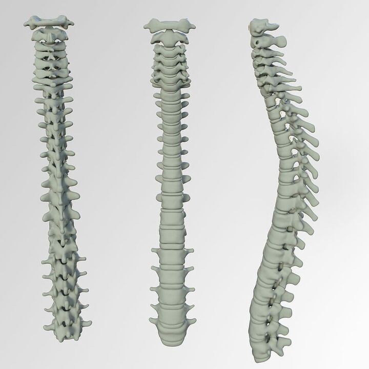 Column scheme