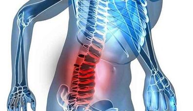 Signs and symptoms of lumbar osteochondrosis