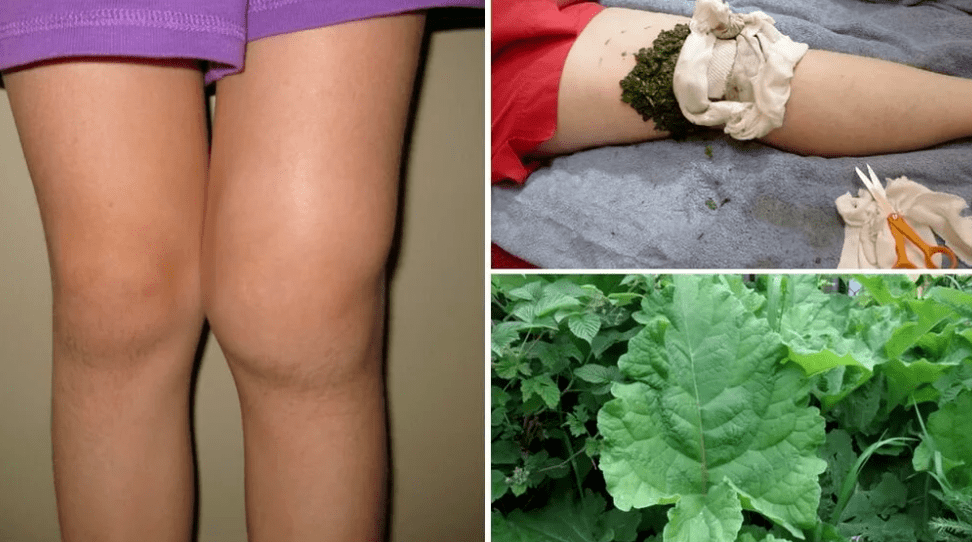 Treatment with folkloric methods
