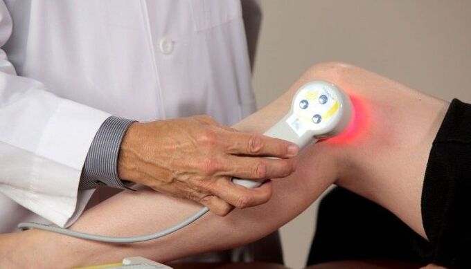 knee osteoarthritis treatment with physiotherapy